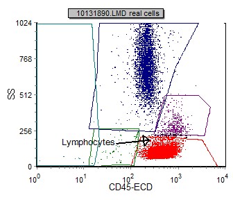 Chronic Lymphocytic Leukemia/small Cell Lymphoma (CLL/SLL) | Flow Cytometry